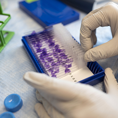 A gloved hand moves microscope slides in a laboratory. 